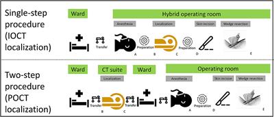 Efficacy and Safety of Preoperative vs. Intraoperative Computed Tomography-Guided Lung Tumor Localization: A Randomized Controlled Trial